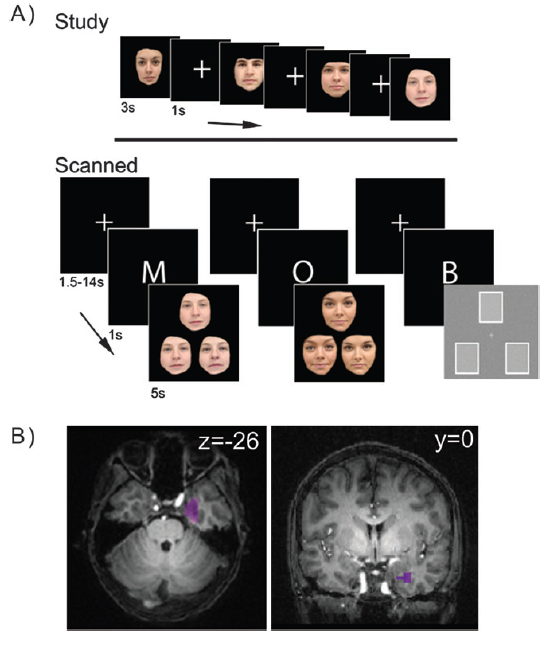 o_neil_protzner_etal_cerebralcortex_2012.png o_neil_protzner_etal_cerebralcortex_2012.png