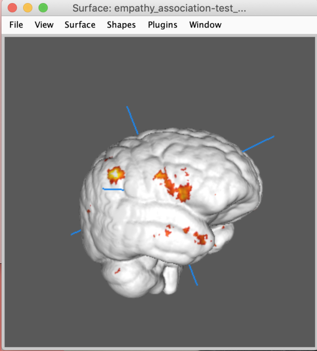 image1_empathy.png image1_empathy.png