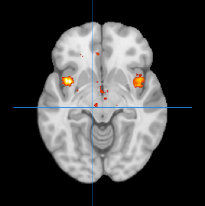 image2_emotion.png image2_emotion.png