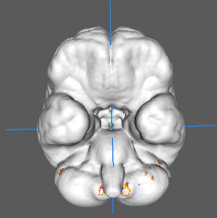 image1_reasoning.png image1_reasoning.png