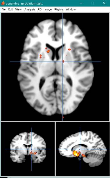 image2_dopamine.jpeg image2_dopamine.jpeg