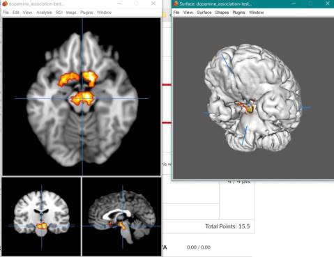 image1_dopamine.jpeg image1_dopamine.jpeg