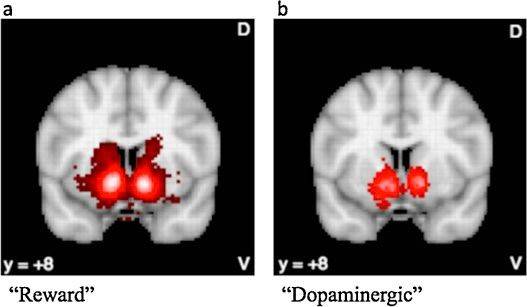 image3_dopamine.jpeg image3_dopamine.jpeg