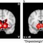 image3_dopamine.jpeg