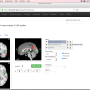 neurosynth_download_icon.png