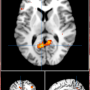 image2_semantic.png