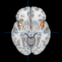image2_emotion.png