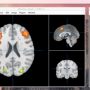 mango_two_overlays_surface_add_overlay.png