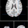 image2_movement.png