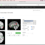 neurosynth_term_thinking.png