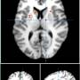 image2_dopamine.jpeg